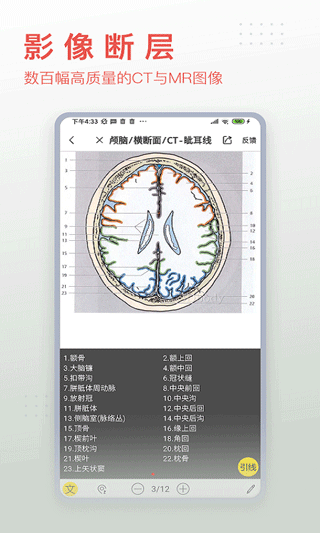 3Dbody解剖app免费版截图1