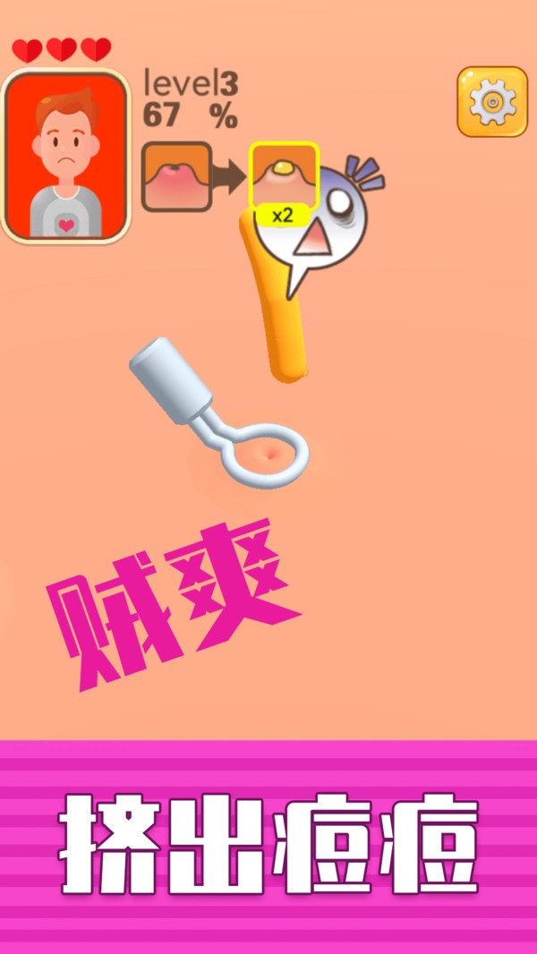 挤痘贼爽小游戏官方版截图4