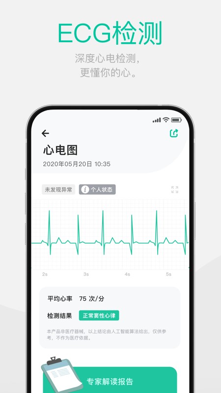 戴乐行血糖手表(Dynasyn)截图2