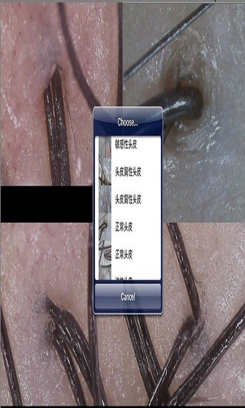 mrkv头皮检测app下载