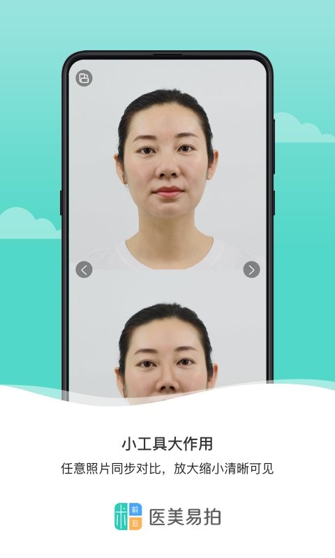医美易拍app下载安装