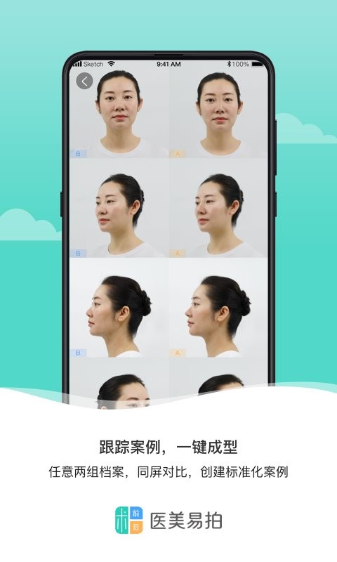 医美易拍手机版截图3