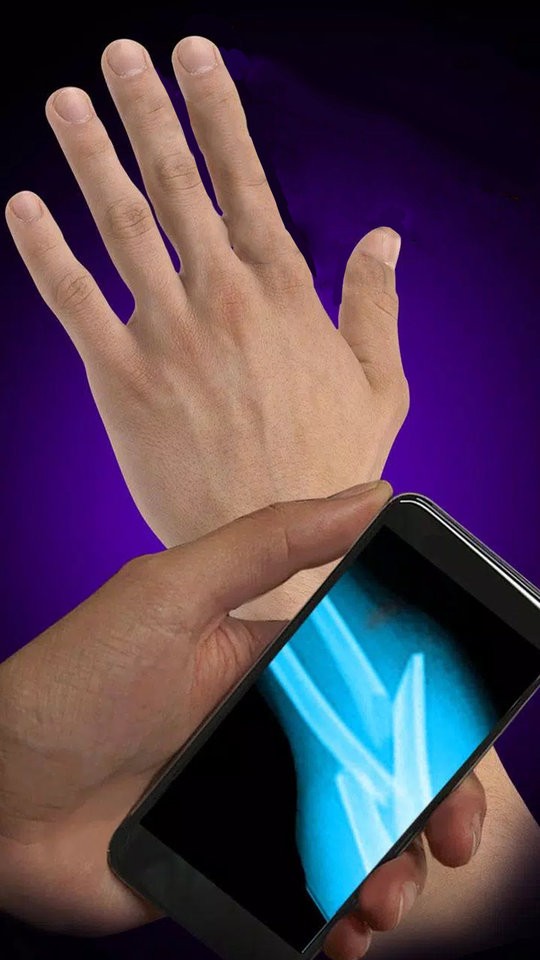 x射线模拟器手机版截图2