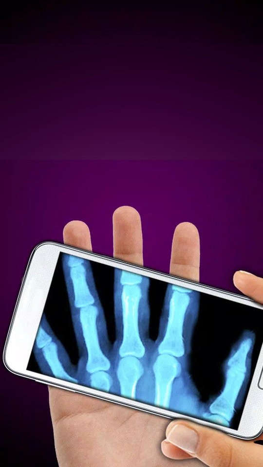 x射线模拟器手机版截图3