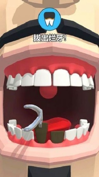 拔牙大师手游(Dentist Bling)截图1