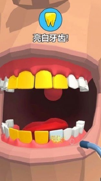 拔牙大师手游(Dentist Bling)截图2